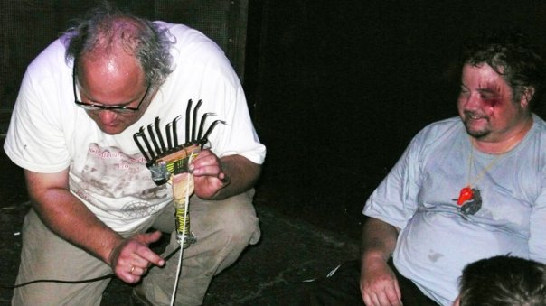 Steve McCabe puts on a brave face after standing on Eugene's rake - Dr Chad tries to make amends for tying his shoelaces together by playing him a song on one of them.